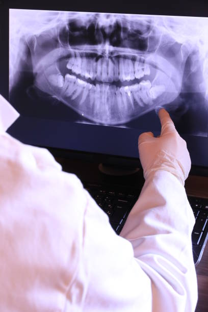Best Emergency Dental Extractions in Edina, MO